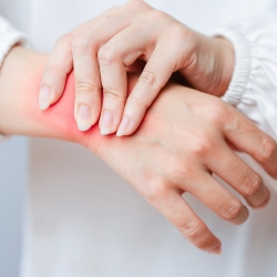 Person med gigt i håndleddet – overvejer ioniseret vand som muligt supplement i Vester Skerninge